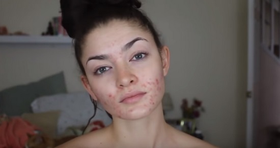 Як наносити макіяж на проблемну шкіру і який?